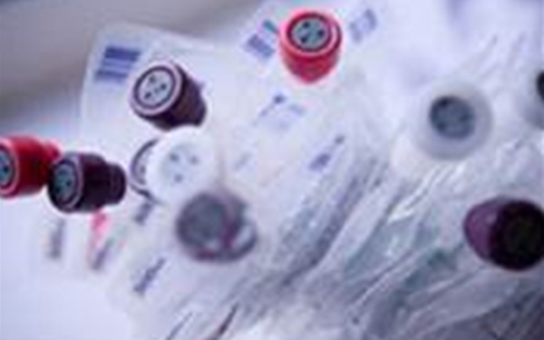 塑料粘結前等離子表面處理